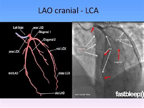 lao cranial view